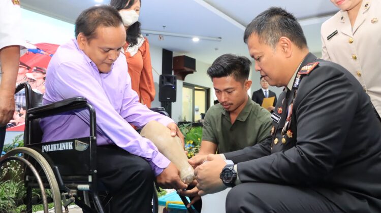 Sentuhan Humanis Hari Bhayangkara ke-80, Kapolres Metro Bekasi Kota Serahkan Bantuan Kaki Palsu